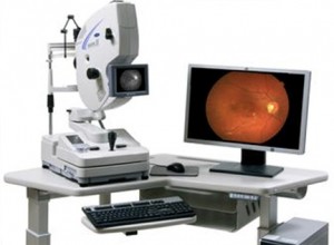 angiografia ocular exame